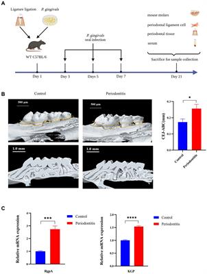 Porphyromonas gingivalis induces an inflammatory response via the cGAS-STING signaling pathway in a periodontitis mouse model
